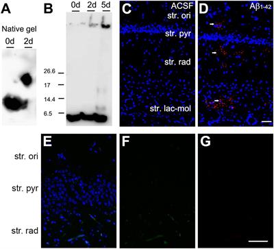 The Acute Effects of Amyloid-Beta1–42 on Glutamatergic Receptor and Transporter Expression in the Mouse Hippocampus